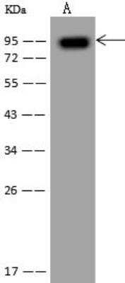 Western Blot gamma Adducin Antibody