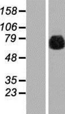 Western Blot gamma Adducin Overexpression Lysate