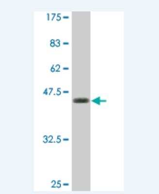 Western Blot: gamma C Crystallin Antibody (7C4) [H00001420-M01C] - Detection against Immunogen (36.74 KDa) 