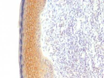 Immunohistochemistry: gamma Catenin Antibody (CTNG/1483) [NBP2-53165] - Formalin-fixed, paraffin-embedded human Skin stained with Catenin, gamma Monoclonal Antibody (CTNG/1483)