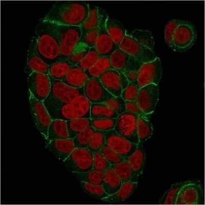 Immunocytochemistry/Immunofluorescence: gamma Catenin Antibody (CTNG/1664) - Azide and BSA Free [NBP2-54524] - Immunofluorescent staining of paraformaldehyde-fixed MCF-7 cells with gamma Catenin Antibody (CTNG/1664) followed by goat anti-Mouse IgG-CF488 (Green). Nuclei are labeled with Red Dot (Red).