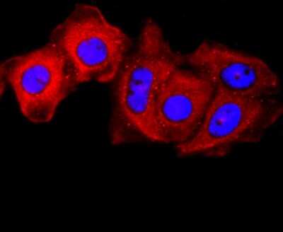 Immunocytochemistry/Immunofluorescence: gamma Catenin Antibody (JF0973) [NBP2-66858] - Staining gamma Catenin in MCF-7 cells (red). The nuclear counter stain is DAPI (blue). Cells were fixed in paraformaldehyde, permeabilised with 0.25% Triton X100/PBS.