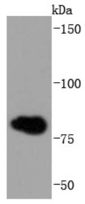 Western Blot: gamma Catenin Antibody (JF0973) [NBP2-66858] - Analysis of gamma Catenin on Hela cells lysates using anti-gamma Catenin antibody at 1/1,000 dilution.