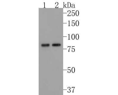 Western Blot: gamma Catenin Antibody (JF0973) [NBP2-66858] - Western blot analysis of gamma Catenin on different lysates. Proteins were transferred to a PVDF membrane and blocked with 5% BSA in PBS for 1 hour at room temperature. The primary antibody (1/500) was used in 5% BSA at room temperature for 2 hours. Goat Anti-Rabbit IgG - HRP Secondary Antibody (HA1001) at 1:5,000 dilution was used for 1 hour at room temperature. Positive control: Lane 1: Hela cell lysate Lane 2: human skin tissue lysate