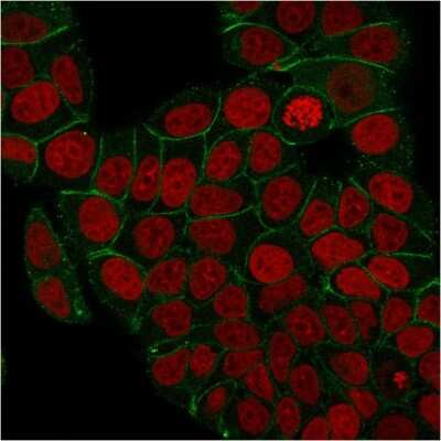 Immunocytochemistry/Immunofluorescence: gamma Catenin Antibody (rCTNG/1664) - Azide and BSA Free [NBP3-08469] - Immunofluorescence staining of PFA-fixed MCF-7 cells with gamma Catenin Mouse Monoclonal Antibody (rCTNG/1664) followed by goat anti- Mouse IgG-CF488 (Green). Nuclei are labeled with RedDot (Red).