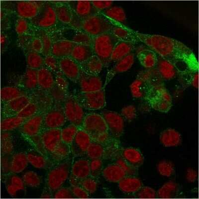 Immunocytochemistry/Immunofluorescence: gamma Catenin Antibody (rCTNG/1664) - Azide and BSA Free [NBP3-08469] - Immunofluorescence staining of PFA-fixed HepG2 cells with gamma Catenin Mouse Monoclonal Antibody (rCTNG/1664) followed by goat anti- Mouse IgG-CF488 (Green). Nuclei are labeled with RedDot (Red).