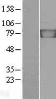 Western Blot gamma Catenin Overexpression Lysate