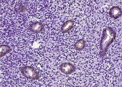 Immunohistochemistry-Paraffin: gamma-Glutamylcyclotransferase/CRF21/GGCT Antibody [NBP3-12540] - Staining of human GGCT in human corpus uteri with rabbit polyclonal antibody (1:10000).