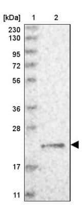 Western Blot: gamma-Glutamylcyclotransferase/CRF21/GGCT Antibody [NBP1-86727] - Lane 1: Marker  [kDa] 230, 130, 95, 72, 56, 36, 28, 17, 11.  Lane 2: Human cell line RT-231