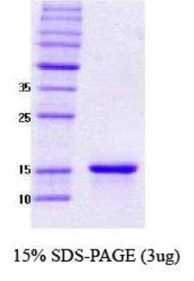 SDS-Page: Recombinant Human gamma-Synuclein Protein [NBC1-18329] -  gamma-Synuclein, 13.3 kDa (127 aa) , confirmed by MALDI-TOF with a purity of 95% by SDS - PAGE