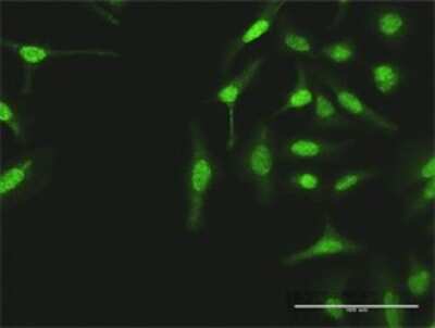 Immunocytochemistry/Immunofluorescence: gamma Tubulin Antibody [H00007283-D01P] - Analysis of antibody to TUBG1 on HeLa cell. Antibody concentration 10 ug/ml.