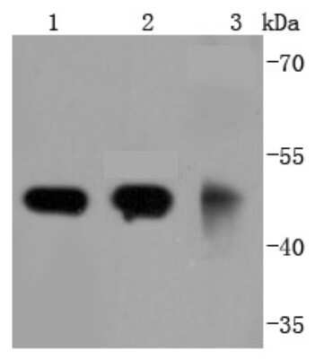 Western Blot: gamma Tubulin Antibody (JF0972) [NBP2-66860] - Analysis of gamma Tubulin on different lysates using anti-gamma Tubulin antibody at 1/1,000 dilution. Positive control: Lane 1: A431 Lane 2: Jurkat Lane 3: Mouse brain