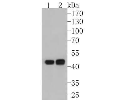Western Blot: gamma Tubulin Antibody (JF0972) [NBP2-66860] - Western blot analysis of gamma Tubulin on different lysates. Proteins were transferred to a PVDF membrane and blocked with 5% BSA in PBS for 1 hour at room temperature. The primary antibody (1/500) was used in 5% BSA at room temperature for 2 hours. Goat Anti-Rabbit IgG - HRP Secondary Antibody (HA1001) at 1:5,000 dilution was used for 1 hour at room temperature. Positive control: Lane 1: Jurkat cell lysate Lane 2: A431 cell lysate