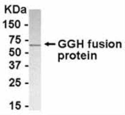 Western Blot: gamma-glutamyl hydrolase Antibody [NB100-75628] - E coli-derived fusion protein as test antigen. Affinity-purified IgY dilution: 1:2000, Goat anti-IgY-HRP dilution: 1:1000. Colorimetric method for signal development. ( anti-GGH )