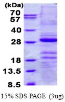 SDS-PAGE Recombinant Human Gastrokine 1 His Protein