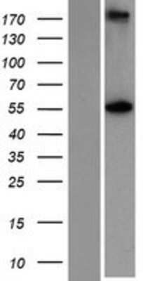 Western Blot: glutamine rich 2 Overexpression Lysate (Adult Normal) [NBP2-06073] Left-Empty vector transfected control cell lysate (HEK293 cell lysate); Right -Over-expression Lysate for glutamine rich 2.