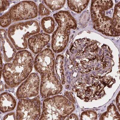 Immunohistochemistry: golgi transport 1 homolog B Antibody [NBP2-38088] - Staining of human kidney shows strong granular cytoplasmic positivity in cells in tubules .