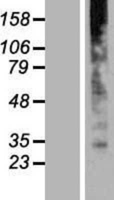 Western Blot: golgi transport 1 homolog B Overexpression Lysate (Adult Normal) [NBP2-07094] Left-Empty vector transfected control cell lysate (HEK293 cell lysate); Right -Over-expression Lysate for golgi transport 1 homolog B.