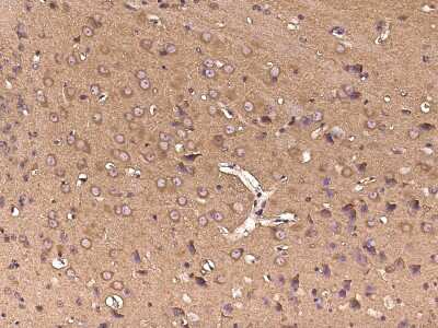 Immunohistochemistry-Paraffin: gp130/CD130 Antibody (223) [NBP2-90444] - Immunochemical staining of mouse gp130/CD130 in mouse heart with rabbit monoclonal antibody (1:10000, formalin-fixed paraffin embedded sections).
