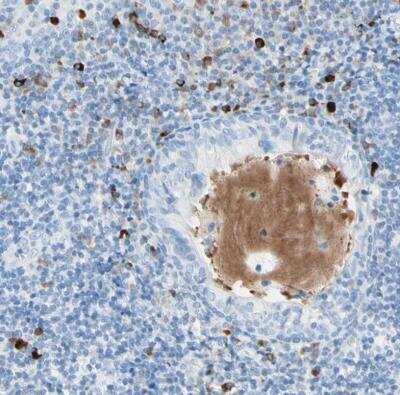 Immunohistochemistry-Paraffin: gp130/CD130 Antibody [NBP1-88138] -  Staining of human plasma shows moderate positivity.