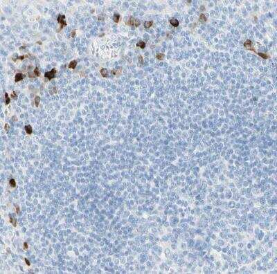 Immunohistochemistry-Paraffin: gp130/CD130 Antibody [NBP1-88138] -  Staining of human tonsil shows strong cytoplasmic positivity in non - germinal center cells.