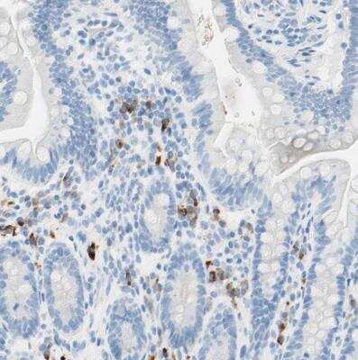 Immunohistochemistry-Paraffin: gp130/CD130 Antibody [NBP1-88138] -  Staining of human small intestine shows strong cytoplasmic positivity in lymphoid cells.