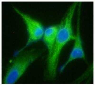 Immunocytochemistry/Immunofluorescence: gp96/HSP90B1/GRP94 Antibody (94B9) [NBP2-59391] - Analysis of GRP94 in U87MG cells line, stained with DAPI (Blue) for nucleus staining and monoclonal anti-human GRP94 antibody (1:100) with goat anti-mouse IgG-Alexa fluor 488 conjugate (Green).