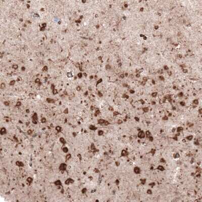 Immunohistochemistry-Paraffin: gp96/HSP90B1/GRP94 Antibody (CL2647) [NBP2-42379] - Staining of human cerebral cortex shows strong cytoplasmic positivity in neurons.