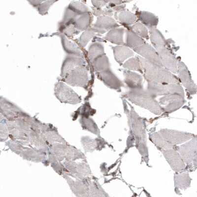 Immunohistochemistry-Paraffin: gp96/HSP90B1/GRP94 Antibody (CL2647) [NBP2-42379] - Staining of human skeletal muscle shows very weak cytoplasmic positivity in myocytes.