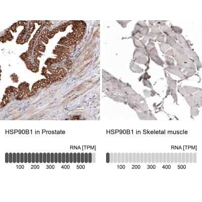 Immunohistochemistry-Paraffin: gp96/HSP90B1/GRP94 Antibody (CL2647) [NBP2-42379] - Staining in human prostate and skeletal muscle tissues using NBP2-42379 antibody. Corresponding HSP90B1 RNA-seq data are presented for the same tissues.