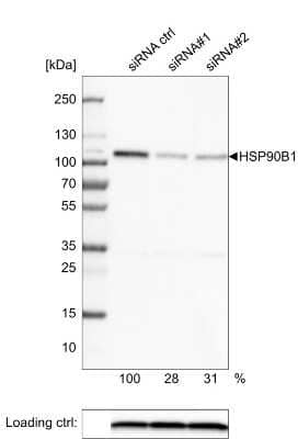 <b>Genetic Strategies Validation and Orthogonal Strategies Validation.</b>Western Blot: gp96/HSP90B1/GRP94 Antibody (CL2647) [NBP2-42379] - Analysis in U-251MG cells transfected with control siRNA, target specific siRNA probe #1 and #2, using Anti-HSP90B1 antibody. Remaining relative intensity is presented. Loading control: Anti-PPIB.