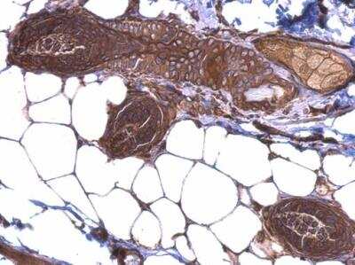 Immunohistochemistry-Paraffin: gp96/HSP90B1/GRP94 Antibody [NBP1-32118] - Mouse skin. HSP90 beta antibody dilution: 1:500. Antigen Retrieval: Trilogy™ (EDTA based, pH 8.0) buffer, 15min.