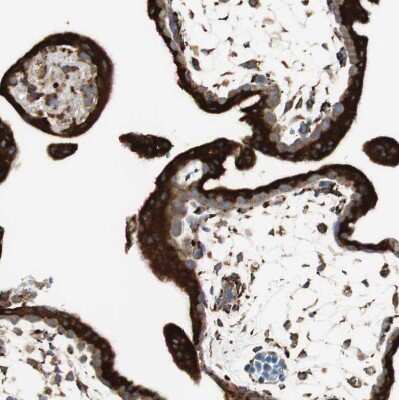 Immunohistochemistry-Paraffin: gp96/HSP90B1/GRP94 Antibody [NBP1-81802] - Staining of human placenta shows strong granular cytoplasmic positivity in trophoblastic cells.