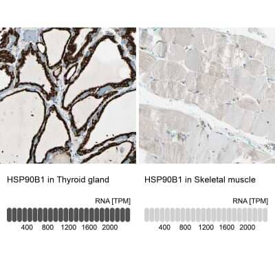 Immunohistochemistry-Paraffin: gp96/HSP90B1/GRP94 Antibody [NBP1-81802] - Staining in human thyroid gland and skeletal muscle tissues using NBP1-81802 antibody. Corresponding HSP90B1 RNA-seq data are presented for the same tissues.