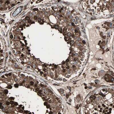 Immunohistochemistry-Paraffin: gp96/HSP90B1/GRP94 Antibody [NBP1-81803] - Staining of human testis shows strong cytoplasmic positivity in cells in seminiferous ducts and Leydig cells.