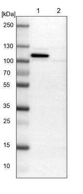 Western Blot: gp96/HSP90B1/GRP94 Antibody [NBP1-81802] - Lane 1: NIH-3T3 cell lysate (Mouse embryonic fibroblast cells). Lane 2: NBT-II cell lysate (Rat Wistar bladder tumor cells).