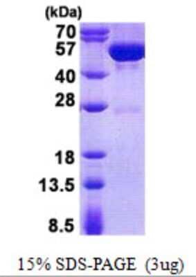 SDS-Page: Recombinant Human Guanine deaminase Protein [NBP2-23093]