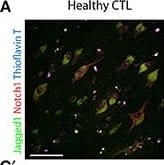 Immunocytochemistry/ Immunofluorescence: Jagged 1 Antibody (1E12) [H00000182-M01A] - Jagged1 expression in brains & CSF of AD patients. Representative double fluorescent immunolabelings for Jagged1 (green) & Notch1 (red) counterstained with Thioflavin-T or DAPI (blue) on postmortem brain sections comprising the hippocampal CA fields from healthy age-matched controls & AD patients (A–C). in healthy controls, Jagged1 is localized to somata of neurons where also Notch1 is expressed. As expected, Thioflavin-T labeling is negligible (A,A′). AD sections show fibrillary aggregates (B,B′) & (C,C′) core plaques double positive for Notch1 & Thioflavin-T. Jag1 expression is scattered in parenchyma & low in, degenerated neurons (white arrows) (B,B′). Jag1 overlays in small double positive aggregates for Notch1 & Thioflavin-T (100x magnification) in radiating plaques with a visible reduction in Jagged1 cellular expression (B–C′). Box plots summarizing the quantification of fluorescence intensities of Jagged1 immunolabeled neurons shows a significant reduction in Jagged1 expression in AD patients (p < 0.001). Image collected & cropped by CiteAb from the following publication (//journal.frontiersin.org/article/10.3389/fncel.2017.00220/full), licensed under a CC-BY license. Not internally tested by Novus Biologicals.