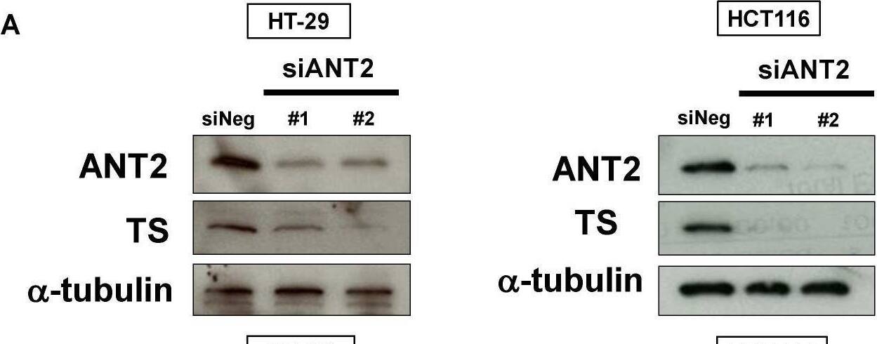 Depletion of ANT2 or PHB2 reduces TS expression and suppresses cell growth. (A) Effects of ANT2 depletion on TS protein expression. TS was analyzed by Western blotting in cells treated with siRNAs (#1 and #2) targeting different sequences of ANT2 gene or siNeg for 48 h (HT-29 cells, left panel) or 72 h (HCT116 cells, right panel).  alpha -Tubulin was used as a loading control. (B) Effects of PHB2 depletion on TS protein expression. TS was analyzed by Western blotting in cells treated with siRNAs (#1 and #2) targeting different sequences of PHB2 gene or siNeg for 48 h (HT-29 cells, left panel) or 72 h (HCT116 cells, right panel).  alpha -Tubulin was used as a loading control. (C) Effects of ANT2 depletion on colony formation. HT-29 cells were treated with siANT2 or siNeg. After further incubation, colonies were fixed and stained with crystal violet. The representative images of stained colonies are shown (upper panel). Colony formation rates are shown in the graph (lower panel). Columns, means (n = 3); bars, SD, * p < 0.05, ** p < 0.01, significantly different from the siNeg-treated control. (D) Effects of PHB2 depletion on colony formation. HT-29 cells were treated with siPHB2 or siNeg. After further incubation, colonies were fixed and stained by crystal violet. The representative images of stained colonies are shown (upper panel). Colony formation rates are shown in the graph (lower panel). Columns, means (n = 3); bars, SD, ** p < 0.01, significantly different from the siNeg-treated control. Image collected and cropped by CiteAb from the following open publication (//pubmed.ncbi.nlm.nih.gov/33652782), licensed under a CC-BY license. Not internally tested by Novus Biologicals.