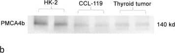 Western Blot: PMCA4 Antibody (2G8) [H00000493-M07] - Identification of plasma membrane calcium ATPase isoform PMCA4b as a renalase binding protein.A, HK-2 cells incubated with either labeled RP-Scr220 or RP-220, biotin-labeled proteins purified using streptavidin column, separated by SDS-PAGE & visualized by western blot using streptavidin-HRP; * = regions evaluated by mass spectrometry in samples labeled with either RP-Scr220 or RP-220; # = RP-220 band containing the plasma membrane calcium ATPase isoform PMCA4b. B, Endogenous expression of PMCA4b in HK-2 cells, western immunoblot using isoform specific monoclonal; CCL-119: human leukemic cell line; thyroid tumor = human thyroid tumor cell line (ATCC, CRL-1803) 10 μg protein loaded in each lane. C, co-immunolocalization of PMCA4b & renalase in HK-2 cells, images acquired using a Zeiss laser scanning confocal microscope, scale bar = 9 μm; arrow = plasma membrane. D, Co-Immunoprecipitation of PMCA4b & renalase from HK-2 cell lysates; renalase-Ab-beads = renalase antibody coated beads; PMCA4b-Ab-beads = PMCA4b antibody coated beads. Image collected & cropped by CiteAb from the following publication (//pubmed.ncbi.nlm.nih.gov/25906147), licensed under a CC0-1.0 license. Not internally tested by Novus Biologicals.