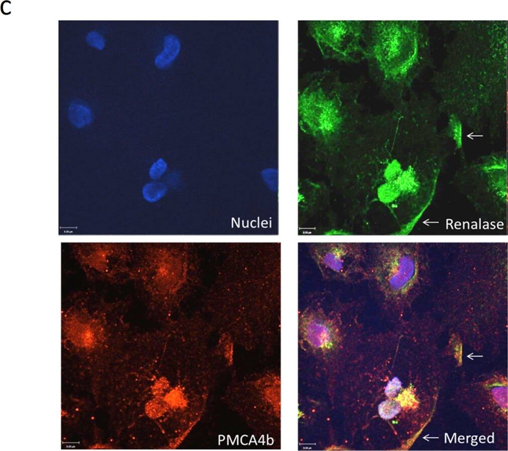 Identification of plasma membrane calcium ATPase isoform PMCA4b as a renalase binding protein.A, HK-2 cells incubated with either labeled RP-Scr220 or RP-220, biotin-labeled proteins purified using streptavidin column, separated by SDS-PAGE and visualized by western blot using streptavidin-HRP; * = regions evaluated by mass spectrometry in samples labeled with either RP-Scr220 or RP-220; # = RP-220 band containing the plasma membrane calcium ATPase isoform PMCA4b. B, Endogenous expression of PMCA4b in HK-2 cells, western immunoblot using isoform specific monoclonal; CCL-119: human leukemic cell line; thyroid tumor = human thyroid tumor cell line (ATCC, CRL-1803) 10 μg protein loaded in each lane. C, co-immunolocalization of PMCA4b and renalase in HK-2 cells, images acquired using a Zeiss laser scanning confocal microscope, scale bar = 9 μm; arrow = plasma membrane. D, Co-Immunoprecipitation of PMCA4b and renalase from HK-2 cell lysates; renalase-Ab-beads = renalase antibody coated beads; PMCA4b-Ab-beads = PMCA4b antibody coated beads. Image collected and cropped by CiteAb from the following open publication (//pubmed.ncbi.nlm.nih.gov/25906147), licensed under a CC0-1.0 license. Not internally tested by Novus Biologicals.