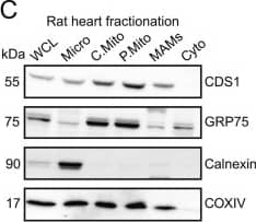 Western Blot: CDS1 Antibody (2D10) [H00001040-M01] - Localisation of CDS1 immunoreactivity & CDS activity to mitochondria.[A, B] Differentiated H9c2 cells fractionated & analysed for [A] CDS1 immunoreactivity by Western blot; [B] CDS activity. [C-E] Rat heart fractionated & analysed for [C] CDS1 immunoreactivity & markers, [D] CDS1 immunoreactivity (entire Western blot shown) & [E] CDS activity. [F–H] Rat heart fractionated in the presence of the protease, subtilisin & analysed for [F] CDS1 immunoreactivity by western blot, [G] CDS activity & [H] PI synthase (PIS) activity. CDS & PIS activity was monitored in triplicate & error bars denote ± S.E.M. COXIV, GRP75 & cyto c are markers for mitochondria, PITPNC1 & PITP alpha  are cytosolic markers & calnexin is a marker for the ER. WCL, whole cell lysate; Micro, microsomes; C.Mito, crude mitochondria; Cyto, cytosol; P.Mito, pure mitochondria, MAMs, mitochondrial associated membranes; PIS, PI synthase; CDS, CDP-diacylglycerol synthase. Image collected & cropped by CiteAb from the following publication (//pubmed.ncbi.nlm.nih.gov/29253589), licensed under a CC-BY license. Not internally tested by Novus Biologicals.