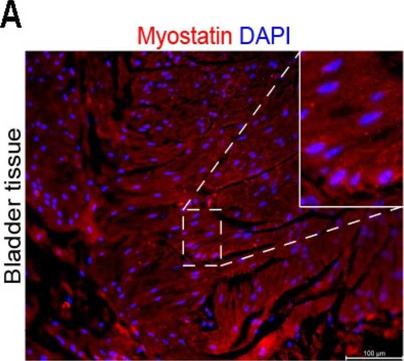 Immunocytochemistry/ Immunofluorescence: GDF-8/Myostatin Antibody (3E7) [H00002660-M07] - Myostatin expression in human bladder smooth muscle tissue & cells. (A) Immunofluorescence staining image of myostatin protein (red) in pediatric bladder muscle tissue. Cell nuclei stained with DAPI (blue). 10× magnification (B) Immunofluorescence staining image of myostatin protein (red) in pediatric bladder-derived hSMCs. 20× magnification (C) Flow cytometry comparison of myostatin-positive cells in pediatric bladder-derived control & ESLUTD hSMCs. (D) Representative immunoblot by WES of active myostatin (48 kDa) & its propeptides (100, 52 kDa) in bladder-derived smooth muscle tissue & cells. GAPDH (40 kDa) as a housekeeping protein. * p ≤ 0.05. Scale bar, 100 μm. Image collected & cropped by CiteAb from the following publication (//pubmed.ncbi.nlm.nih.gov/36901894), licensed under a CC-BY license. Not internally tested by Novus Biologicals.