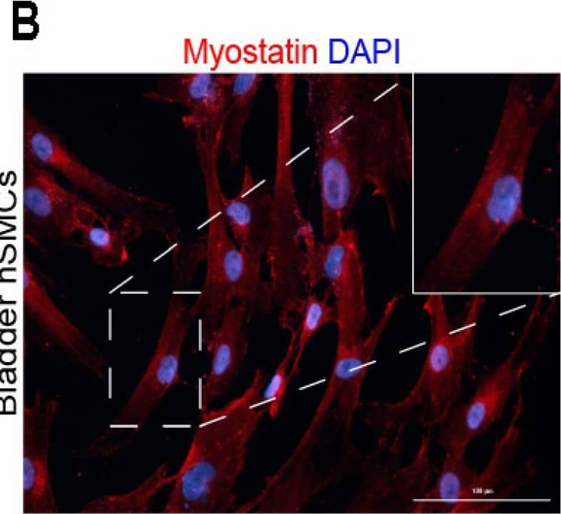 Immunocytochemistry/ Immunofluorescence: GDF-8/Myostatin Antibody (3E7) [H00002660-M07] - Myostatin expression in human bladder smooth muscle tissue & cells. (A) Immunofluorescence staining image of myostatin protein (red) in pediatric bladder muscle tissue. Cell nuclei stained with DAPI (blue). 10× magnification (B) Immunofluorescence staining image of myostatin protein (red) in pediatric bladder-derived hSMCs. 20× magnification (C) Flow cytometry comparison of myostatin-positive cells in pediatric bladder-derived control & ESLUTD hSMCs. (D) Representative immunoblot by WES of active myostatin (48 kDa) & its propeptides (100, 52 kDa) in bladder-derived smooth muscle tissue & cells. GAPDH (40 kDa) as a housekeeping protein. * p ≤ 0.05. Scale bar, 100 μm. Image collected & cropped by CiteAb from the following publication (//pubmed.ncbi.nlm.nih.gov/36901894), licensed under a CC-BY license. Not internally tested by Novus Biologicals.