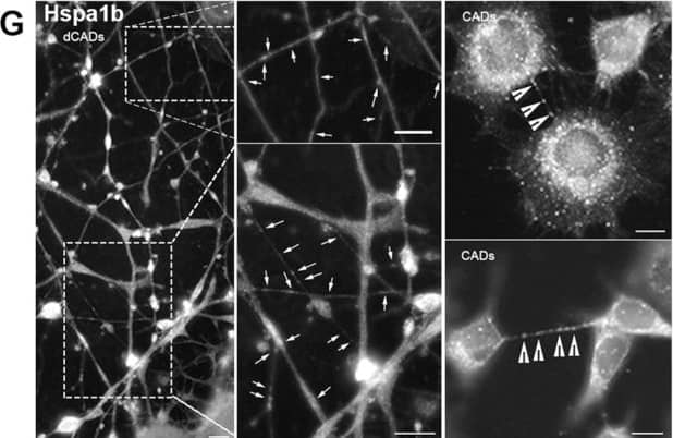 Immunocytochemistry/ Immunofluorescence: HspA1B Antibody (3B7) [H00003304-M02] - Validation of the LCM/MS data from cellular protrusions using microscopy. Immunofluorescence (IF) of proteins identified by LCM/MS (A–D) “expected” or (E–H) “not expected” to be within protrusions based on their known functions/localizations. (A) Cd47 & (B) Anxa2 are found in both hCAD/dCAD protrusions. (C) Tenm2 is found within hCAD protrusions & (D) Cobl in GCs. Interestingly, (E) Grk5 was observed in hCAD protrusions; (F) Hist1h3b protein in hCAD protrusions & GCs (G) Hspa1b in dCAD protrusions & TNTs & (H) Arg1 in dCAD protrusions, GCs, & TNTs. White arrows/arrowheads show punctates within dCAD/hCAD protrusions & GCs or within TNTs, respectively. Scale bars = 10 μm. IF of all 8 proteins corroborate the LCM/MS protein identification for each subtypes of protrusions. (I) 1198 unique proteins were identified by LCM/MS to be in protrusions & 169 were found to be exclusive to protrusions. 904 of the 1198 proteins found in protrusions & 87 out of 169 exclusive proteins had images in the HPA Subcell database. IF images for the proteins identified by LCM/MS in protrusions, present in the HPA Subcell database, were observed & catalogued as being observed or not in protrusions (Figure S2). On average 4.7% of proteins are found in protrusions in the HPA database, 13.6% are found in our LCM isolated protrusions & 23% were found in the “exclusive” LCM protrusions. The fold enrichment increases by 2.9% or 4.8% when we looked at proteins identified by LCM/MS in protrusions or exclusive to protrusions, respectively. Image collected & cropped by CiteAb from the following publication (//pubmed.ncbi.nlm.nih.gov/30866487), licensed under a CC-BY license. Not internally tested by Novus Biologicals.