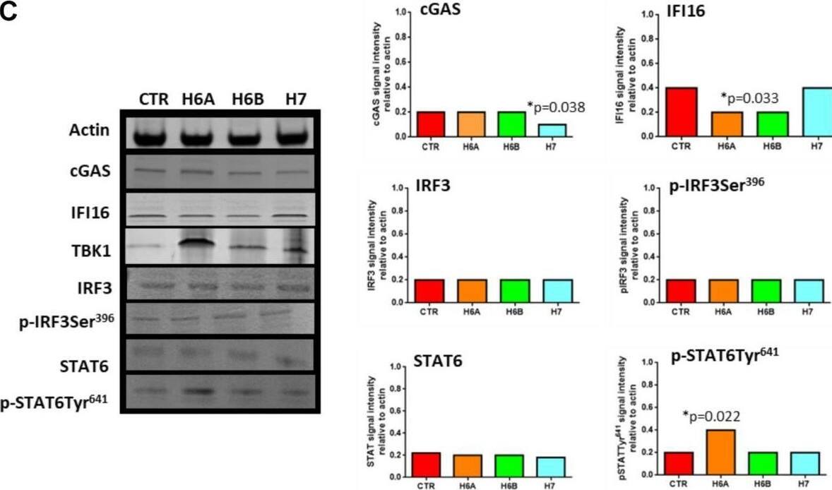 STING pathway analysis. (A) STING mRNA relative expression in uninfected (CTR), HHV-6A, HHV-6B or HHV-7 infected NK92 cells 3d.p.i. ∗p values Student t test; (B) Western Blot analysis for house-keeping actin (upper blot) and STING (lower blot) expression in uninfected (CTR), HHV-6A, HHV-6B or HHV-7 infected NK92 cells 3d.p.i. For stimulation of the cytoplasmic DNA sensing pathways, we used 2′,3′-cGAMP. The molecular weights were determined by protein ladder (14.4-97.4kDa) (BioRad). Actin was evidenced at 44kDa, STING 35kDa. The images were acquired by Geliance 600 (Perkin Elmer, MA, United States). The complete Western Blots are reported in Supplementary Figure S3. ∗p value Student t test. The histogram represents the STING band intensity in relation with the corresponding actin band. (C) Western Blot analysis for house-keeping actin (upper blot) and cGas, IFI16, TBK1, IRF3, pIRF3Ser396, STAT6, pSTAT6Tyr641 (lower blots) expression in uninfected (CTR), HHV-6A, HHV-6B or HHV-7 infected NK92 cells 3 d.p.i. The molecular weights were determined by protein ladder (25-250kDa; 14.4-97.4 kDa). Actin was evidenced at 44kDa, cGas at 68kDa, IFI16 at 100kDa, TBK1 at 80kDa, IRF3 at 55kDa, STAT6 at 120kDa. The histogram represents the STING band intensity in relation with the corresponding actin band. ∗p value Student t test. The images were acquired by Geliance 600 (Perkin Elmer, MA, United States). The complete Western Blots are reported in Supplementary Figure S3. (D) HHV-6A infected NK92 cells were characterized by immunofluorescence for STING [anti-STING PE Ab (Clone T3-680)], STAT6 [anti-STAT6 FITC (Clone D-1)] and gp116 (Clone 6A5) expression. (Nikon Eclipse TE2000S) equipped with a digital camera. Original magnification 100×. Uninfected NK92 cells were used as control. Image collected and cropped by CiteAb from the following open publication (//pubmed.ncbi.nlm.nih.gov/32140147), licensed under a CC-BY license. Not internally tested by Novus Biologicals.