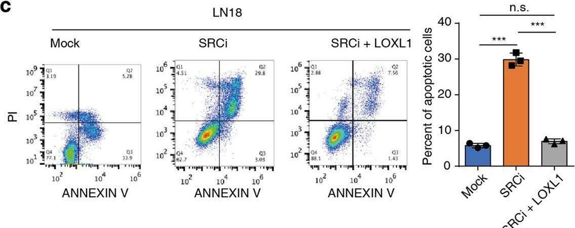 VEGFR-Src axis signaling increases LOXL1 expression which positively correlates with BAG2 during glioma progression.a Left panel, inhibitor screen of receptor-mediated signaling pathways required for LOXL1 upregulation in U87 cells; right panel, inhibitor screen of central kinases required for LOXL1 upregulation in U87 cells. b Knocking down of SRC gene by siRNA reduced LOXL1 protein in LN18 cells. c Forced expression of LOXL1 rescued the inhibition of Src kinase activity, as determined using apoptosis assays (means +/- SD, one-way ANOVA). d Upper panel, Promo web software predicted the potential transcriptional factors that bound to the LOXL1 promoter (3000 bp upstream of the TSS); Lower panel, a ChIP assay identified that CEBPA targeted the LOXL1 promoter at 480 base pairs upstream of the TSS in LN18 cells (means +/- SD, unpaired t test, two-tailed). e Knocking down CEBPA reduced LOXL1 expression in LN18 cells. Four pairs of siRNAs were applied to target the CEBPA gene. f Real-time qPCR analyses of glioma specimens were performed. The correlation of LOXL1 expression with CEBPA is shown as R2 and p value. g Representative images of IHC staining of glioma specimens are shown. Scale bar, 100 μm. h Semi-quantitative scoring (using a scale from 0 to 300 points) was conducted, and Pearson’s correlation test was performed and evaluated using the R2 and p value. i Blood LOXL1 levels were measured using ELISA, and 21 glioma specimens were divided into two groups: high (H) or low (L) (means +/- SD, unpaired t test, two-tailed). j BAG2 levels were higher in the H group than in the L group. (means +/- SD, unpaired t test, two-tailed) k Diagram showing the mechanism by which LOXL1 exerts its antiapoptotic activity. Image collected and cropped by CiteAb from the following open publication (//pubmed.ncbi.nlm.nih.gov/32424143), licensed under a CC-BY license. Not internally tested by Novus Biologicals.