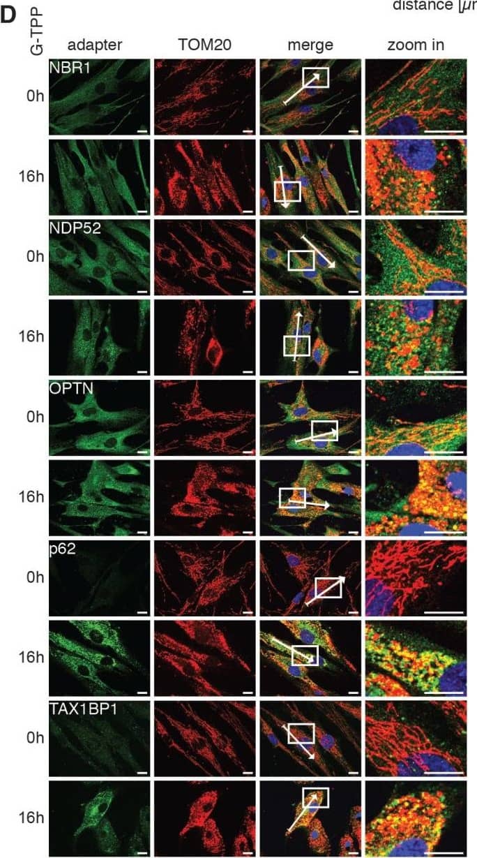 Immunocytochemistry/ Immunofluorescence: NBR1 Antibody (6B11) [H00004077-M01] - G-TPP activity is conserved in primary fibroblasts(A, C) Fibroblasts were treated with 15 µM G-TPP for the indicated time points. Cells were harvested & western blots were probed with antibodies against (A) PINK1, pS65-Ub & total Ub or (C) autophagy adapter proteins. GAPDH & Vinculin served as loading control. G-TPP treatment led to PINK1 stabilization & pS65-Ub induction in primary skin fibroblasts. p62 levels were induced upon G-TPP treatment, while other adapters seemed decreased. (B, D) Human fibroblasts were treated with 15 µM G-TPP for 16 h & fixed & stained with antibodies against (B) pS65-Ub (green) or (D) the autophagy adapters NBR1, NDP52, p62, OPTN & TAX1BP1 (green). Mitochondria were stained with antibodies against TOM20 (red), nuclei were visualized with Hoechst (blue). Scale bars indicate 10 µM. A magnified image of the boxed region, the fluorescence profile along the arrow & the Pearson’s correlation coefficient of adapter protein & mitochondrial stainingare shown to the right. Shown is the mean ± SEM of at least five randomly selected images (unpaired, two-sided t-test, ***p < 0.0005). Image collected & cropped by CiteAb from the following publication (//www.oncotarget.com/lookup/doi/10.18632/oncotarget.22287), licensed under a CC-BY license. Not internally tested by Novus Biologicals.