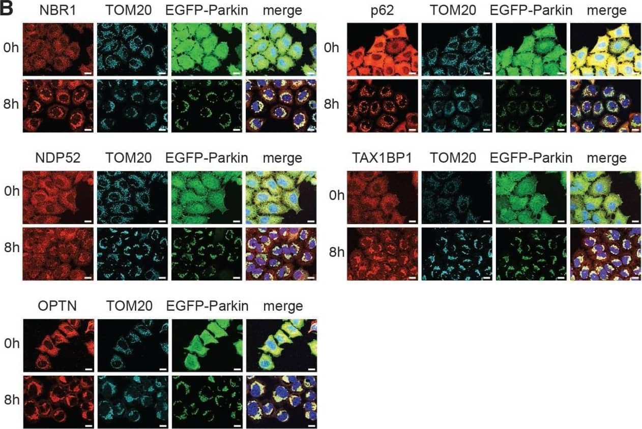 Immunocytochemistry/ Immunofluorescence: NBR1 Antibody (6B11) [H00004077-M01] - G-TPP leads to recruitment of autophagy adapters & degradation of mitochondria(A) HeLa cells stably expressing untagged Parkin were treated with 10 µM G-TPP for 8 h. Western blots were prepared from cell lysates & probed with antibodies against LC3, phospho-TBK1 (Ser172) & TBK1. GAPDH was used as a loading control. Upon 8 h the levels of LC3-I & LC3-II were both increased. At 8 h after treatment with G-TPP but not at 4 or 24 h, TBK1 was phosphorylated. (B) HeLa cells stably expressing EGFP-Parkin were treated with 10 µM G-TPP & fixed 8 h after treatment. Cells were stained with antibodies against the autophagy adapter proteins NBR1, NDP52, OPTN, p62, & TAX1BP1 (red). Mitochondria were counterstained with TOM20 antibodies (cyan), nuclei with Hoechst (blue). EGFP-Parkin epifluorescence is shown in green. Scale bar corresponds to 10 µM. (C) HeLa cells stably expressing EGFP-Parkin & the reporter protein mitoKeima were treated with 10 µM CCCP or G-TPP & imaged over time. The ratio of ‘neutral’ mitoKeima to ‘acidic’ mitoKeima was calculated as readout for mitophagy. Parkin translocation was monitored at the same time. Values for Parkin translocation & mitophagy were normalized to 12 h treatment with 10 µM CCCP as positive control & DMSO as negative control (two-way ANOVA with Tukey’s post-hoc test, **p < 0.005, ***p < 0.0005). Image collected & cropped by CiteAb from the following publication (//www.oncotarget.com/lookup/doi/10.18632/oncotarget.22287), licensed under a CC-BY license. Not internally tested by Novus Biologicals.