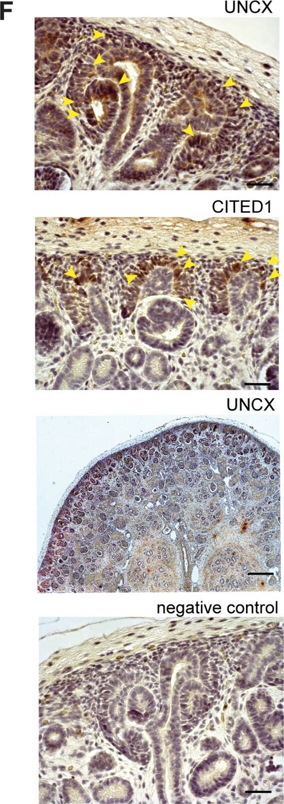 Immunohistochemistry: CITED1 Antibody (5H6) [H00004435-M03] - The nephrogenic niche exhibited a complex spatial organization.(A) Pseudotime analysis of the nephrogenic niche (NPC) & the PTA. Two-dimensional DDRTree [18] embedding & the learned graph (shown as a black line) were calculated with Monocle 2 [17]. Labels & colors indicate cell types. (B) Schematic sketch of the CM indicating the distance d from the UB to the edge of the CM (solid arrow) & the relative distance s along the UB (dashed arrow), in which 0 & 1 represent the top & bottom of the CM, respectively. (C) Representative image of SIX2 & CITED1 immunostaining in a w15 human fetal kidney. Dashed lines in the insets indicate the outline of the nuclei, based on DAPI signal. Arrows in the inset point to cells in which CITED1 is concentrated in the nucleus. Scale bar = 50 μm. (D) Quantification of SIX2 & CITED1 immunostaining with respect to the distance d from UB or distance s along the UB; see panel A. Error bars indicate the SEM calculated over all evaluated profiles (n = 24). (E) Representative image of HSPA1A, NR4A1, & CKS2 immunostaining in a w15 human fetal kidney. Scale bar = 20 μm. (F) Representative image of UNCX & CITED1 immunostaining. Arrowheads indicate the presence of immunostaining signal. Scale bar = 100 μm. The numerical data underlying this figure can be found in S1 Data. CM, cap mesenchyme; NPC, nephron progenitor cell; PTA, pretubular aggregate; SEM, standard error of the mean; UB, ureteric bud; w15, week 15. Image collected & cropped by CiteAb from the following publication (//pubmed.ncbi.nlm.nih.gov/30789893), licensed under a CC-BY license. Not internally tested by Novus Biologicals.